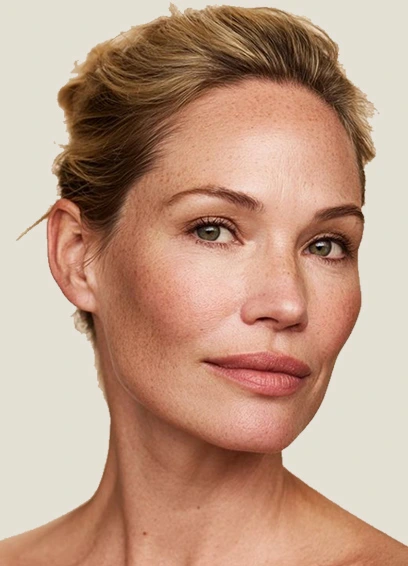 Facial Bioregeneration NATURAL FIT Body Contouring® Barcelona