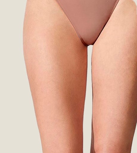 Lipoescultura de Muslos