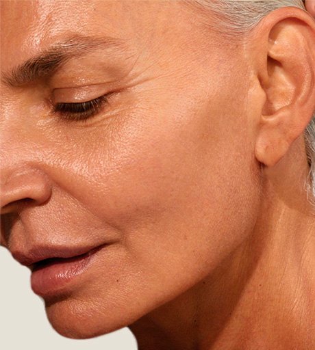 C&oacute;mo se realiza Rejuvenecimiento con C&eacute;lulas Madre