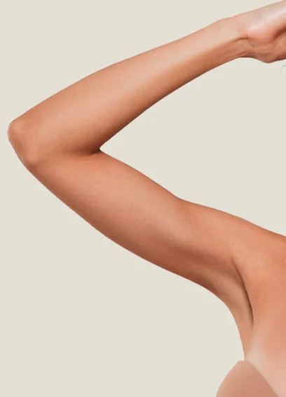 C&oacute;mo se realiza Lipoescultura de Brazos