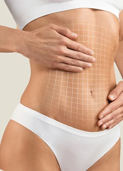 C&oacute;mo se realiza Lipoescultura