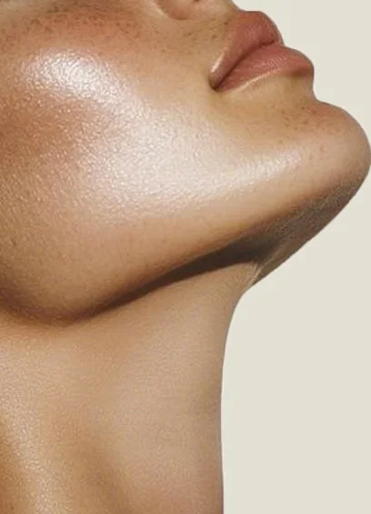 C&oacute;mo se realiza Lipoescultura de Cuello y Papada
